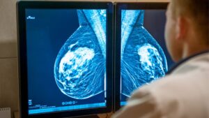 Section Spotlight – Breast Imaging