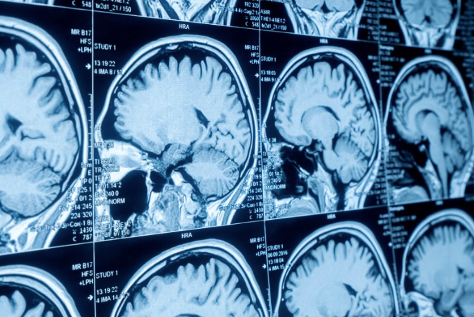 What Happens After Your Imaging Exam? A Radiologist’s Perspective